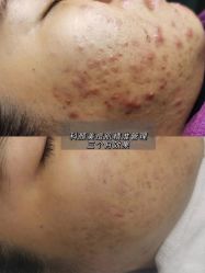 -美肤盾祛痘·问题肌头疗管理中心