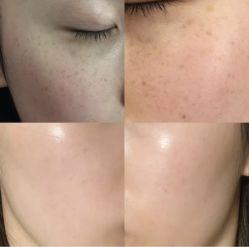 -Cream88颜皮肤管理中心