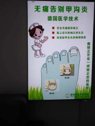 点击看大图 -德哥灰指甲脚气甲沟炎跖疣护理