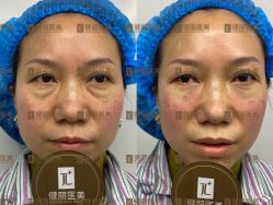 点击看大图 -广州健丽·去眼袋医疗美容机构