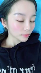 体验前-紫洁俪方（北京）医疗美容