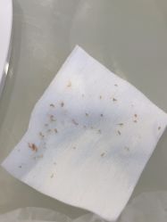 -塑青春&伊肤泉祛痘皮肤管理