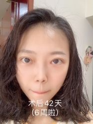 -八大处整形