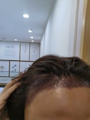 -熙朵美学植发连锁