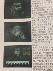 -杭州贝瑞斯美华妇儿医院·早孕·产检·儿科