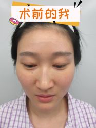 -素美医疗美容·西南眼鼻整形·修复基地