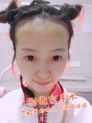 -大麦微针植发丨全国连锁