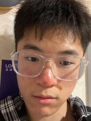 体验后-重庆联合丽格第五医疗美容医院