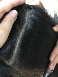 -章光101防脱养发荟
