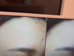 -苑苑vbeauty科技美容SPA