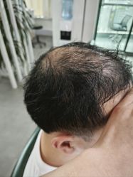 -极客侠男士假发定制补发