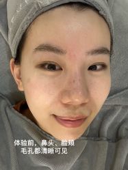 -ST时柒·问题肌抗衰美颜所