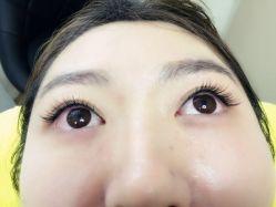 点击看大图 -YooMee优美智能科技美肤机构
