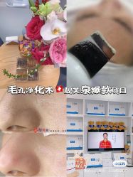 -靓芙泉祛痘.科技美肤连锁