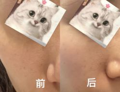 体验前-星和深湾荟医疗美容