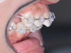 -新达口腔(华东理工大学店)