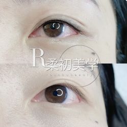 -RC半永久纹眉纹发际线