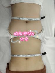 -Lily纤美·科技减脂中心