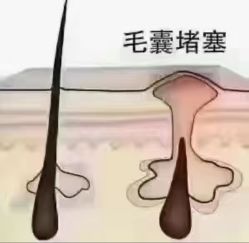 -Bollins波林丝•专研护发中心