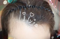 -大麦微针植发全国连锁