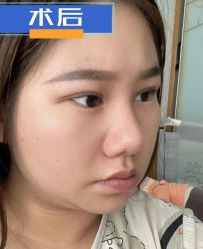 -素美医疗美容·西南眼鼻整形·修复基地