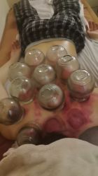 -悦艾堂·中医拔罐减肥·美体艾灸连锁