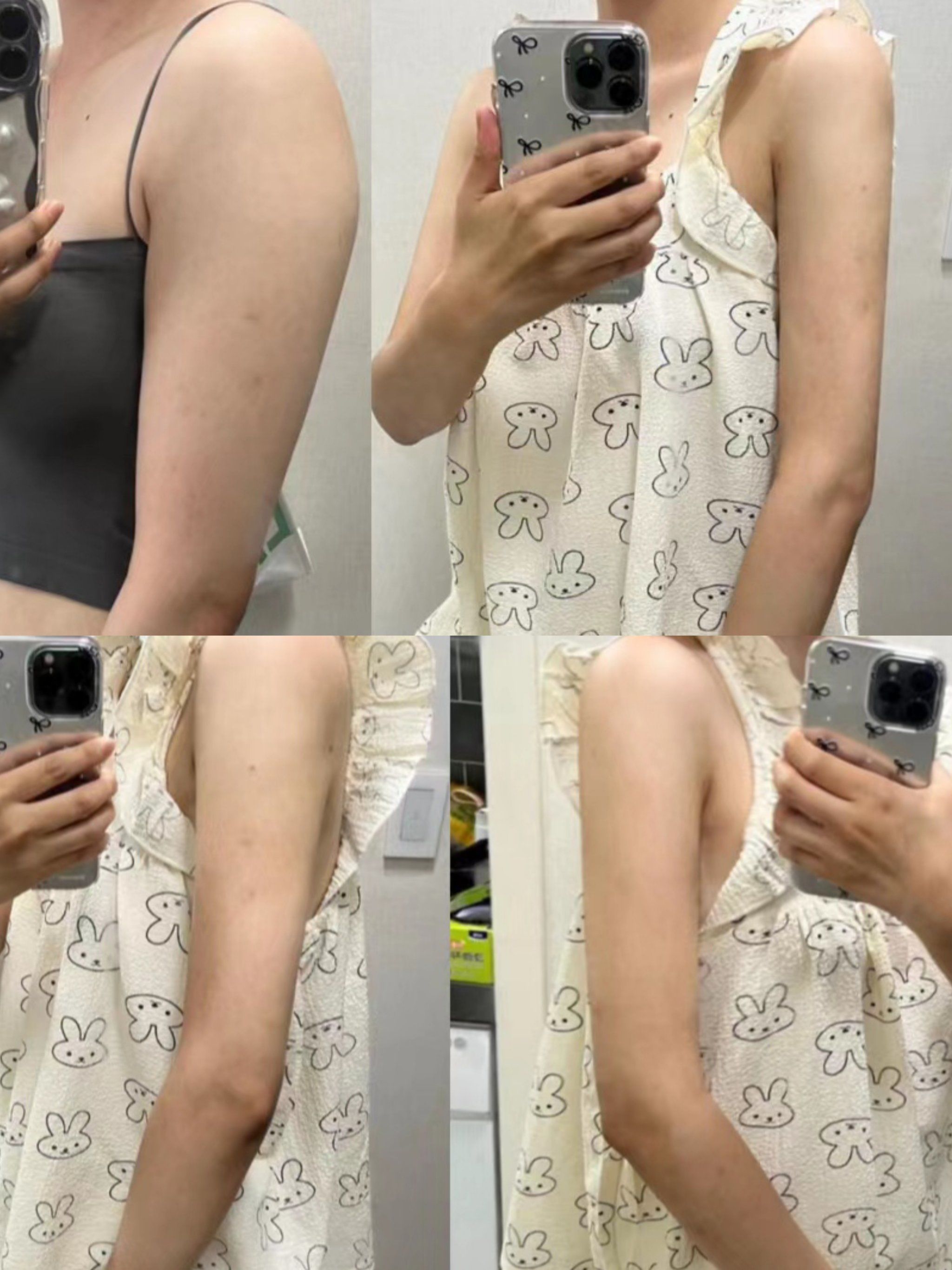 浅记录下我的细手臂