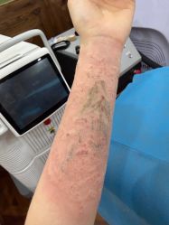 -雲艺刺青·洗纹身