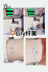 -Lily纤美·科技减脂中心