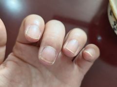 -世龙世家甲沟炎·灰指甲·嵌甲矫正·修脚(武侯区双楠店)