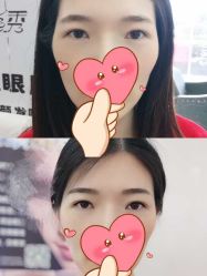 雾眉➕美瞳线-平萍纹绣韩式半永久定妆