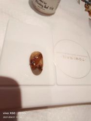 -安吉拉青春化管理中心