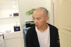 点击看大图 -大麦微针植发丨全国连锁