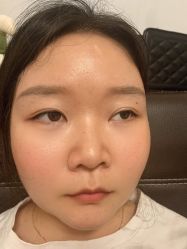 体验后-丽都整形美容医院·全国连锁旗舰店