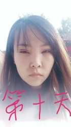 体验后-四川娇点医学美容医院