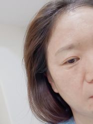 -海涛医疗美容·面部抗衰·注射美鼻