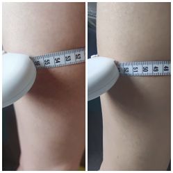 -苗塑堂减肥·艾灸