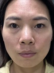 -上海伊莱美医疗美容医院