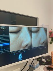 -苑苑vbeauty科技美容SPA