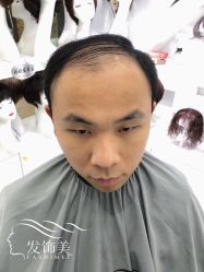 -发饰美男士增发补发假发定制店