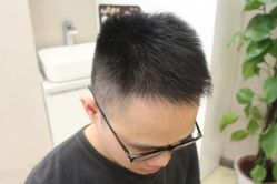 点击看大图 -大麦微针植发丨全国连锁