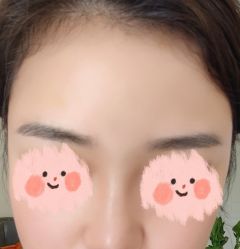 体验后-北京楚诺医疗美容