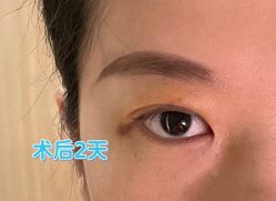 -联合丽格·张菡丽格医疗美容