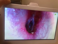 -川耳坊专业采耳馆