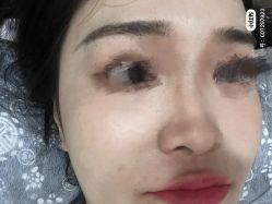 点击看大图 体验前-Yestar艺星医疗美容医院