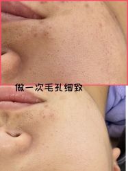 点击看大图 -Cream88颜皮肤管理中心