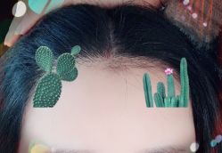 -大麦微针植发全国连锁