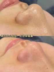 -LUNA皮相美·骨相美高级美感