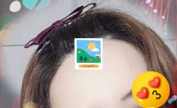 -大麦微针植发全国连锁