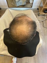 -乐绅男士高端假发定制